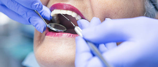 Best Emergency Denture Repair in Orofino, ID